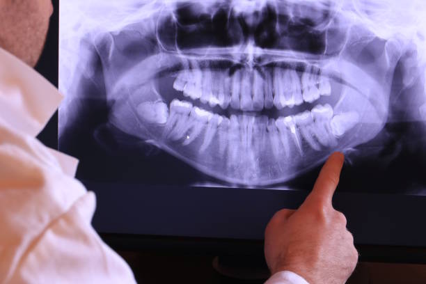 Best Emergency Dental Care for Trauma or Injury in New Bedford, PA