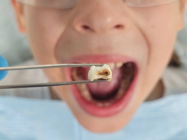 Best Emergency Treatment for Toothache in New Bedford, PA